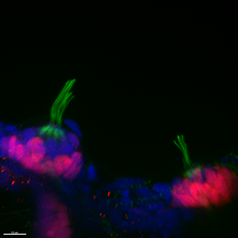 3 dpf_WT embryo 2 3.ome_2019-04-07T13-53-57.943