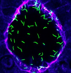 Left-right cilia